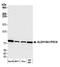 Aldehyde Dehydrogenase 18 Family Member A1 antibody, A304-803A, Bethyl Labs, Western Blot image 