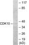 Cyclin Dependent Kinase 10 antibody, EKC1818, Boster Biological Technology, Western Blot image 