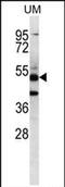 Pancreatic Lipase Related Protein 3 antibody, PA5-71749, Invitrogen Antibodies, Western Blot image 