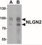 Neuroligin 2 antibody, NBP2-41299, Novus Biologicals, Western Blot image 