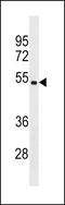 Carbohydrate Sulfotransferase 5 antibody, LS-C159351, Lifespan Biosciences, Western Blot image 