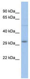 Distal-Less Homeobox 5 antibody, TA329352, Origene, Western Blot image 