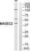 MAGE Family Member C2 antibody, abx015152, Abbexa, Western Blot image 