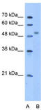 Zinc Finger Protein 763 antibody, TA342133, Origene, Western Blot image 