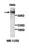 Zyxin antibody, orb77045, Biorbyt, Western Blot image 
