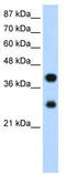 CTBP antibody, TA345905, Origene, Western Blot image 