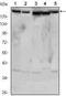 RPTOR Independent Companion Of MTOR Complex 2 antibody, TA336802, Origene, Western Blot image 