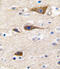 Cytochrome P450 Family 2 Subfamily R Member 1 antibody, abx033748, Abbexa, Immunohistochemistry frozen image 