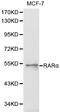 Bleomycin Hydrolase antibody, LS-C192653, Lifespan Biosciences, Western Blot image 