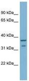 Ral GEF With PH Domain And SH3 Binding Motif 2 antibody, TA344941, Origene, Western Blot image 