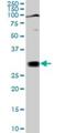 TGFB Induced Factor Homeobox 2 antibody, H00060436-M02, Novus Biologicals, Western Blot image 