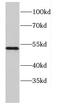 Papillary thyroid carcinoma-encoded protein antibody, FNab01364, FineTest, Western Blot image 