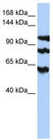 Protein Phosphatase 1 Regulatory Subunit 13B antibody, TA342553, Origene, Western Blot image 