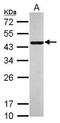 Cilia And Flagella Associated Protein 46 antibody, GTX119794, GeneTex, Western Blot image 