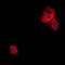 VGF Nerve Growth Factor Inducible antibody, LS-C352987, Lifespan Biosciences, Immunofluorescence image 