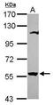 2'-5'-Oligoadenylate Synthetase Like antibody, PA5-34873, Invitrogen Antibodies, Western Blot image 