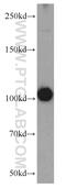 Phosphodiesterase 2A antibody, 55306-1-AP, Proteintech Group, Western Blot image 