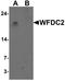 WAP Four-Disulfide Core Domain 2 antibody, TA326648, Origene, Western Blot image 