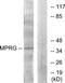 Progestin And AdipoQ Receptor Family Member 5 antibody, TA311716, Origene, Western Blot image 