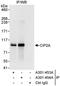 Protein CIP2A antibody, A301-453A, Bethyl Labs, Immunoprecipitation image 