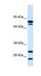 Zinc Finger Protein 606 antibody, NBP1-80028, Novus Biologicals, Western Blot image 