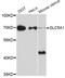 Solute Carrier Family 5 Member 1 antibody, A11976, ABclonal Technology, Western Blot image 