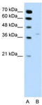 Hydroxysteroid 17-Beta Dehydrogenase 1 antibody, TA346185, Origene, Western Blot image 