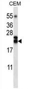 TNF Superfamily Member 4 antibody, AP54317PU-N, Origene, Western Blot image 