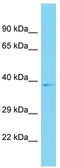 Coiled-Coil Domain Containing 198 antibody, TA330669, Origene, Western Blot image 