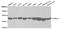 Proteasome 26S Subunit, ATPase 4 antibody, A06099, Boster Biological Technology, Western Blot image 
