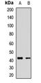 Potassium channel subfamily K member 9 antibody, LS-C668772, Lifespan Biosciences, Western Blot image 