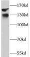 Phosphorylase Kinase Regulatory Subunit Alpha 1 antibody, FNab06391, FineTest, Western Blot image 