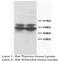 RUNX Family Transcription Factor 2 antibody, GTX38531, GeneTex, Western Blot image 
