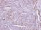 Zinc Finger DHHC-Type Containing 11 antibody, NBP2-15166, Novus Biologicals, Immunohistochemistry frozen image 