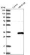 Abhydrolase Domain Containing 12B antibody, NBP1-88669, Novus Biologicals, Western Blot image 