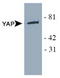 Yes Associated Protein 1 antibody, TA301498, Origene, Western Blot image 