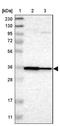 Lymphocyte Transmembrane Adaptor 1 antibody, NBP1-83662, Novus Biologicals, Western Blot image 