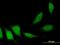 Adaptor Protein, Phosphotyrosine Interacting With PH Domain And Leucine Zipper 2 antibody, H00055198-M06, Novus Biologicals, Immunocytochemistry image 
