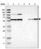 Protein Phosphatase, Mg2+/Mn2+ Dependent 1B antibody, NBP1-87250, Novus Biologicals, Western Blot image 