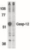 Caspase-12 antibody, PA5-19963, Invitrogen Antibodies, Western Blot image 