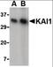 CD82 Molecule antibody, orb87303, Biorbyt, Western Blot image 