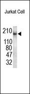RB Binding Protein 6, Ubiquitin Ligase antibody, 251916, Abbiotec, Western Blot image 