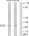 Homeobox protein SIX6 antibody, TA314305, Origene, Western Blot image 