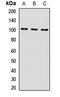 Insulin Receptor Related Receptor antibody, LS-C667859, Lifespan Biosciences, Western Blot image 