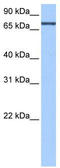 Adenosine Deaminase Domain Containing 2 antibody, TA343989, Origene, Western Blot image 