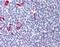 Neuroepithelial Cell Transforming 1 antibody, orb87577, Biorbyt, Immunohistochemistry paraffin image 