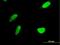 Bifunctional 3 -phosphoadenosine 5 -phosphosulfate synthase 2 antibody, H00009060-B01P, Novus Biologicals, Immunocytochemistry image 