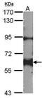 Proto-oncogene tyrosine-protein kinase Yes antibody, PA5-27228, Invitrogen Antibodies, Western Blot image 