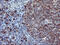 Joining Chain Of Multimeric IgA And IgM antibody, M02644, Boster Biological Technology, Immunohistochemistry paraffin image 