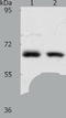Acyl-CoA Thioesterase 11 antibody, TA322344, Origene, Western Blot image 
